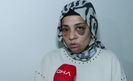 Eski eşinin ailesi sokakta pusu kurdu