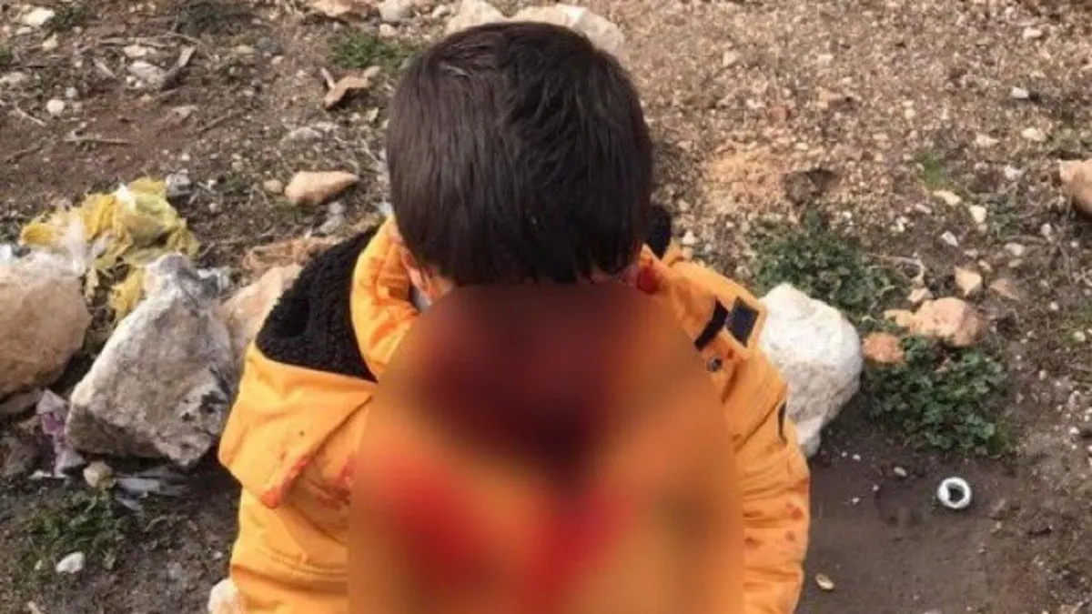 Adıyaman’da köpek dehşeti!