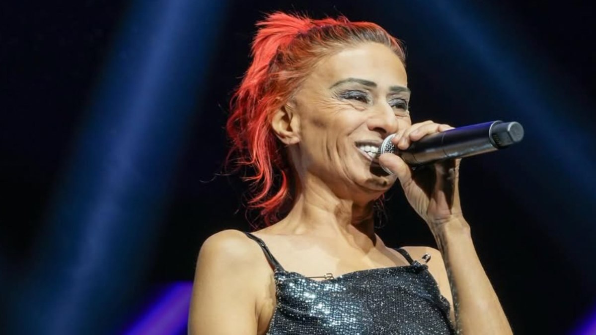 Yüzü yanan Yıldız Tilbe’den yeni tarz